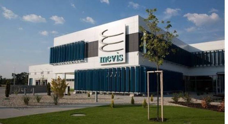 Mevis rozširuje výrobu v Šamoríne: s čínskym partnerom vstupuje do biznisu s batériami