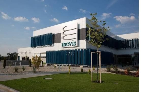 Mevis rozširuje výrobu v Šamoríne: s čínskym partnerom vstupuje do biznisu s batériami